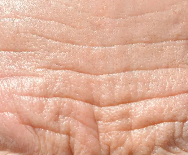 Efficacité de l'huile de nigelle contre les rides